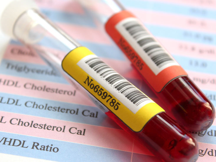 دستورالعمل جدید انجمن قلب آمریکا برای کاهش کلسترول 