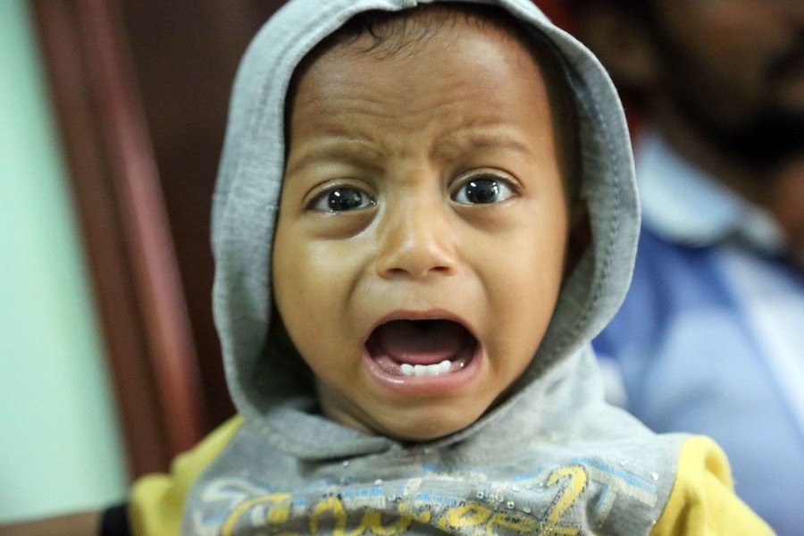 ۸۵۰۰۰ کودک یمنی از گرسنگی جان باخته‌اند