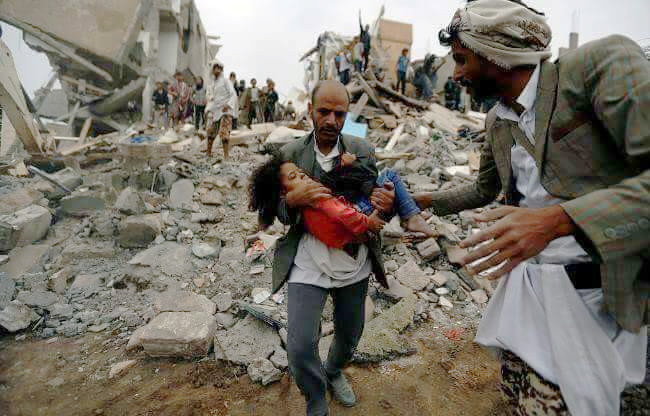 رد پای آمریکا در جنگ خونین یمن