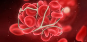 آشنایی با عواملی که احتمال لخته شدن خون در رگ‌ها را بالا می‌برد