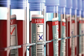 واکنش رئیس اداره ایدز به ابتلای تعدادی از اهالی روستای چنارمحمودی به ویروس HIV