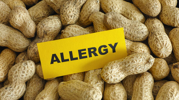 food Allergy