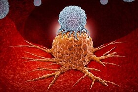 نابودی سلول‌های سرطانی با تلفیق داروهای دو سرطان