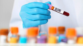 واکنش ایران به ویروس جدید | هانتاویروس را رصد می‌کنیم