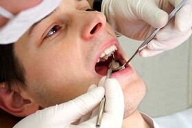 بیماری لثه موجب افزایش فشارخون می‌شود