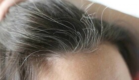 ۱۰ دلیل سفید شدن موها و ۵ توصیه برای پیشگیری از آن