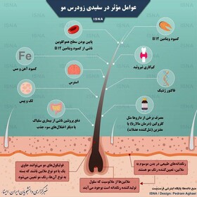 اینفوگرافیک | عوامل مؤثر در سفیدی زودرس مو