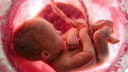 ویدئو | تغییر جنسیت جنین فقط با ۴۰۰ میلیون تومان!