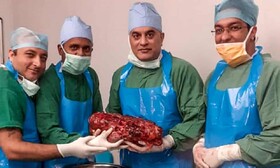 پزشکان هندی کلیه ۷.۴ کیلوگرمی را از بدن یک بیمار خارج کردند