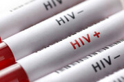 اینفوگرافیک | HIV همان ایدز است؟ | ۶ باور غلط درباره ایدز | ویروس HIV چه مدت در بدن قابل شناسایی نیست؟