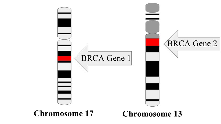 BRCA gene