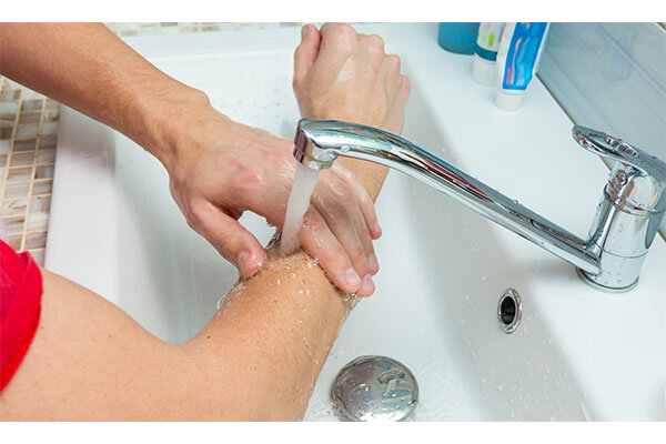 درمان سوختگي - شستن دست