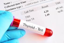 thyroid test