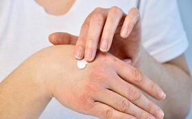 چگونه خشکی پوست دست را برطرف کنیم؟