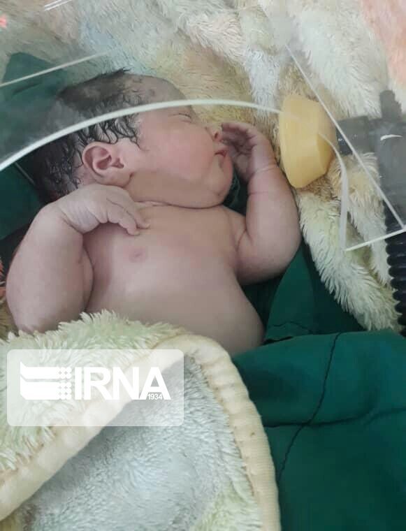 تصویر تولد نوزاد متولد شده از مادر مبتلا به کرونا در بابل