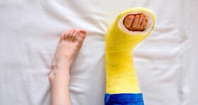 جراحی کاهش وزن موجب افزایش ریسک شکستگی استخوان‌ها می‌شود؟