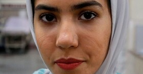 تصاویر اثر جای ماسک بر صورت پرستاران بیماران کرونایی