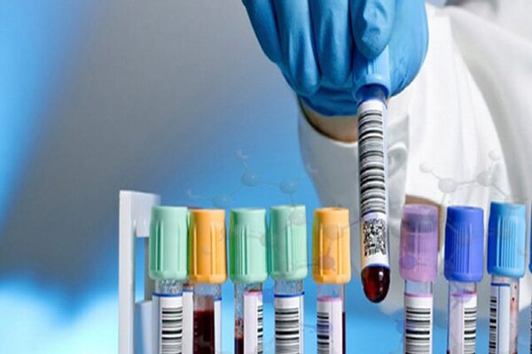 کیت آزمایشگاهی