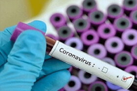 نقش کودکان در پراکندن ویروس کرونا چیست؟