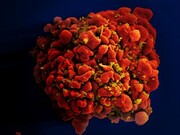 ژنوم ویروس ایدز در یک نمونه بافتی از سال ۱۹۶۶ یافت شد