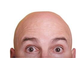 نتایج یک بررسی: احتمال ابتلا به بیماری شدید کرونا در مردان طاس بیشتر است