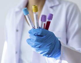 نتایج یک بررسی ژنتیکی: گروه خونی با خطر بیماری شدید کرونا ارتباط دارد