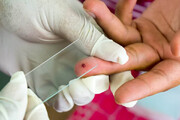 اتباع بیگانه عامل شیوع مالاریا در سراوان