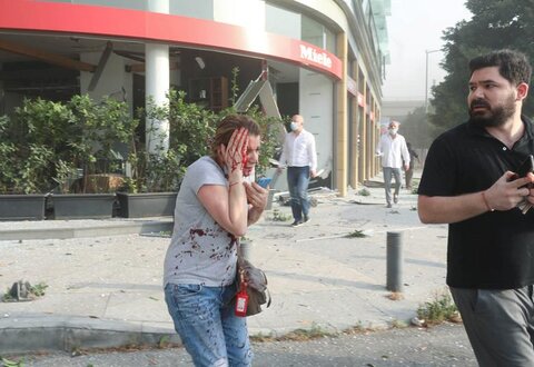 زن زخمی و آسیب دیده پس از انفجار بیروت