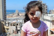 عکس روز | دخترک مجروح لبنانی