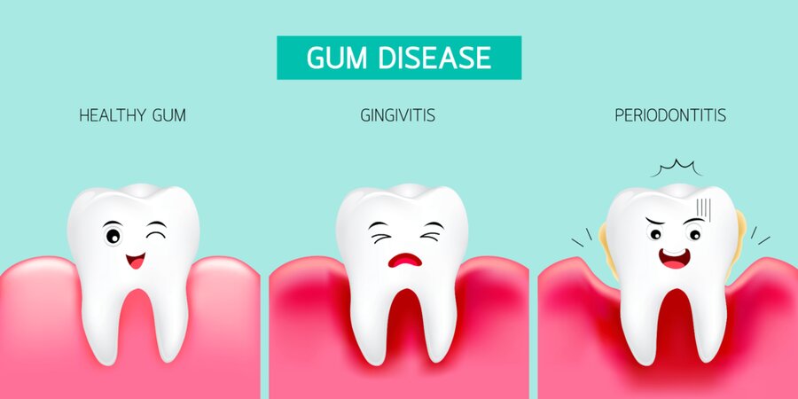 diabetes gum disease treatment
