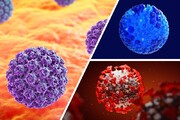 آیا ویروس پاپیلومای انسانی HPV باعث سرطان گلو می شود؟