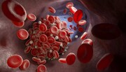 یک علت احتمالی لخته شدن خون در بیماری کووید-۱۹ کشف شد