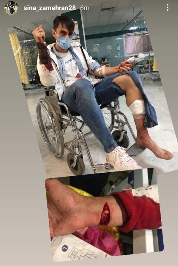 عکس | حمله سارقان خشن و آسیب جدی به بازیکن لیگ برتری