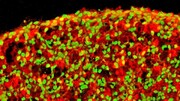 گامی مهم در درمان دیابت نوع ۱ با کمک سلول‌های بنیادی