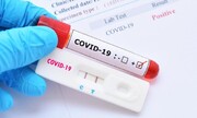 فهرست جدید آزمایشگاه‌های مجاز تشخیص کووید-۱۹ منتشر شد