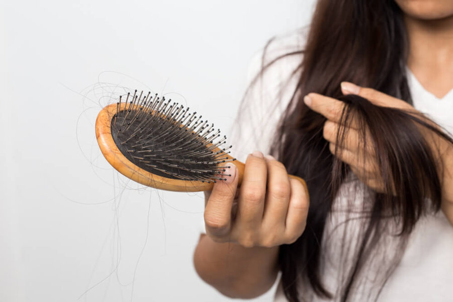 دلایل رایج نازک شدن ناگهانی موی سر
