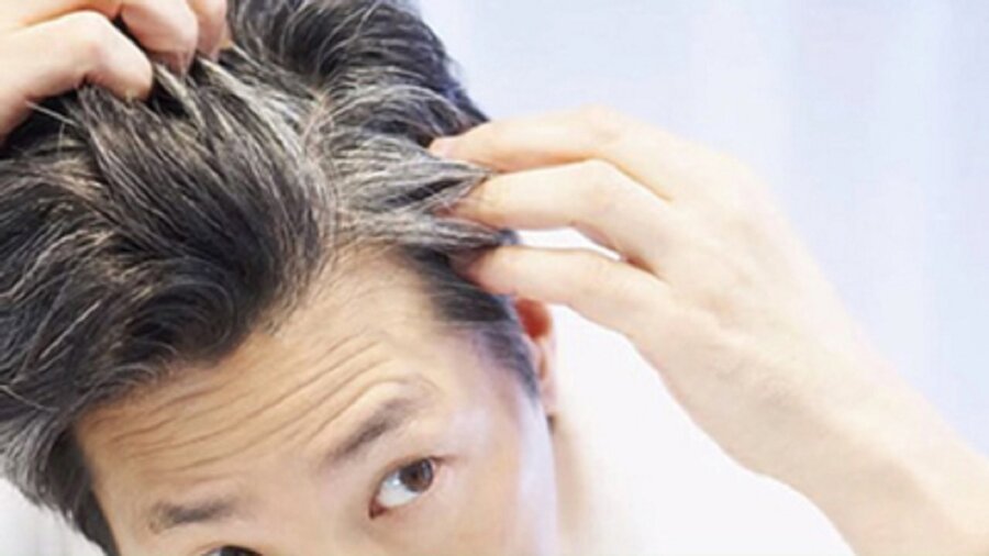  علت سفید شدن مو | برای جلوگیری از سفید شدن مو چه ویتامینی بخوریم