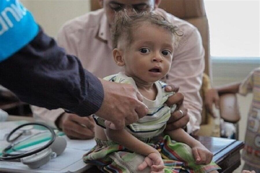 کودک یمنی