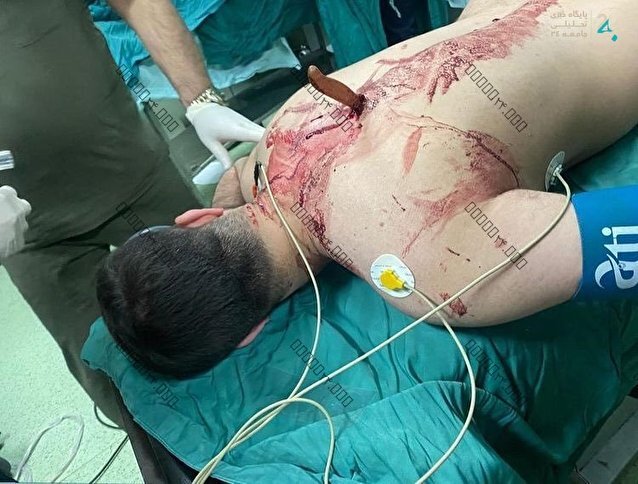 عکس ۱۸+ | حمله با چاقو به پرستارِ یکی از بیمارستان‌های تهران