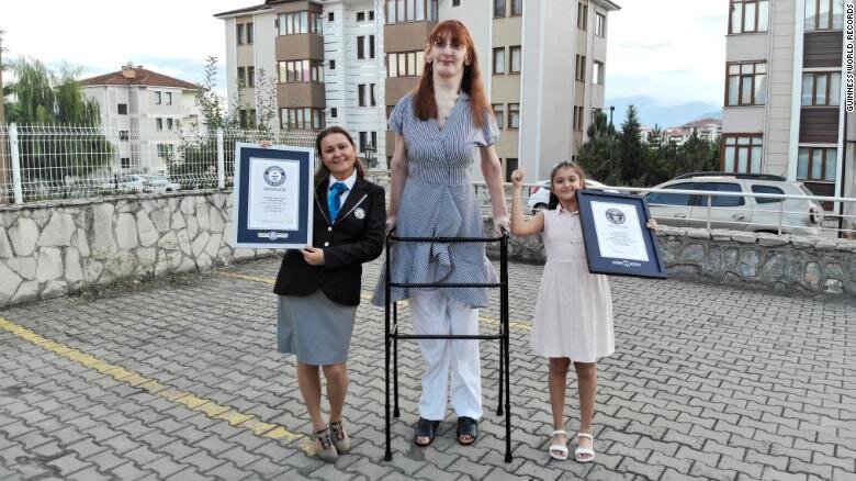 بلندترین زن زنده دنیا از ترکیه