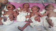 چهارقلوهای شیرازی چشم‌انتظار کمک نیکوکاران برای ترخیص از بیمارستان