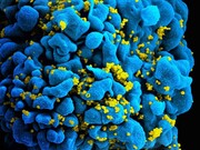 شناسایی دومین مورد رهایی از ویروس ایدز بدون مداخله پزشکی