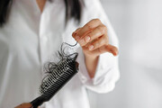 با ریزش مو خداحافظی کنید | روش ساخت ۴ شامپوی پرپشت کننده موی سر در خانه