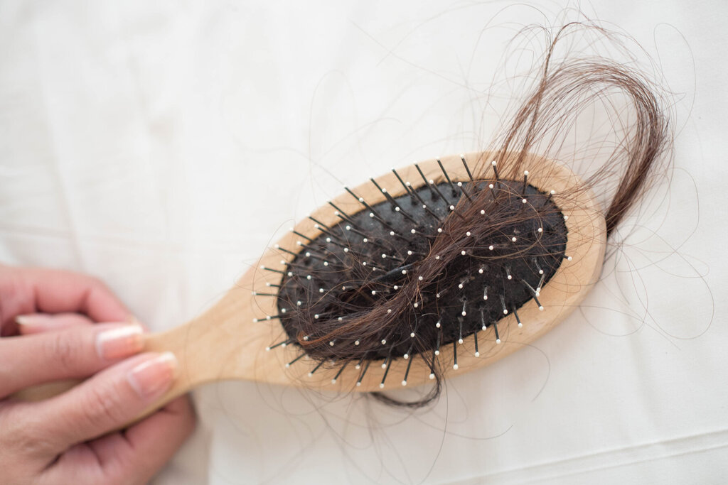 hair loss - ریزش مو