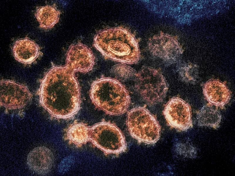 virus