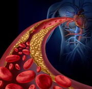 گوشت قرمز چطور به قلب شما آسیب می‌رساند| مشکل در روده‌های شماست!