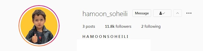 عکس | شوک بزرگ ماجرای پسر ساعد سهیلی و گلوریا هاردی