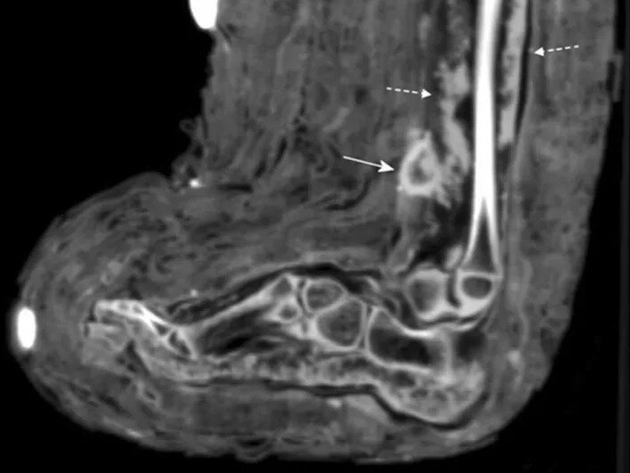 رازهایی که یک کودک مومیاییشده از پزشکی باستانی آشکار میکند