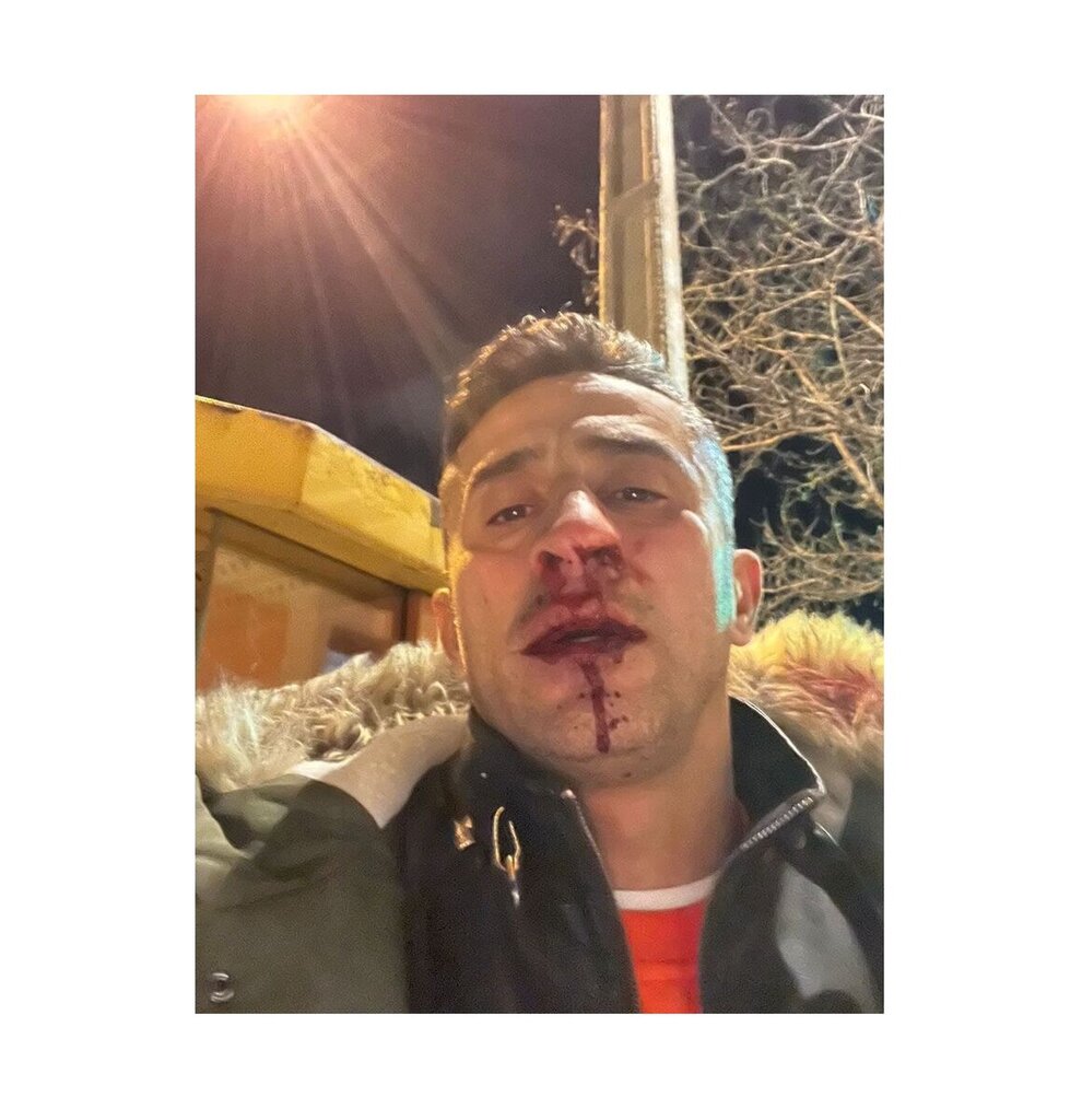 عکس | درگیری خونین در فوتبال ایران | کتک کاری شدید سرمربی پرسپولیسی