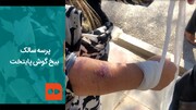 ببینید | پرسه سالک، بیخ گوش تهران | گزارشی تکان‌دهنده از افزایش شیوع یک بیماری انگلی در چند روستای ورامین